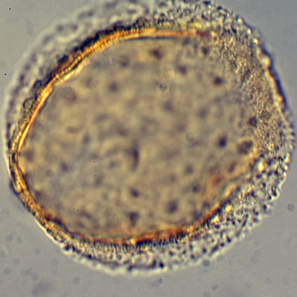 Grano de polen de Cordia lutea (foto en microscopio de luz). Foto: Patricia Jaramillo Díaz & M. Mar Trigo, CDF, 2011.
