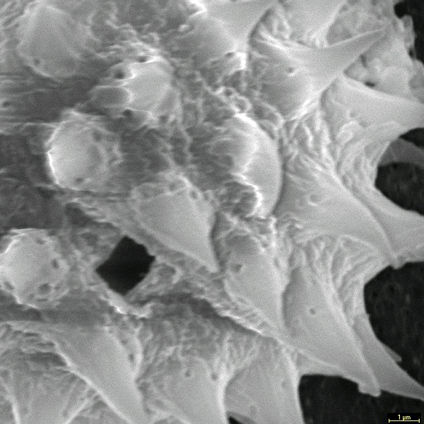 Grano de polen de Acmella darwinii (foto en microscopio electrónico). Foto: Patricia Jaramillo Díaz & M. Mar Trigo, CDF, 2011.