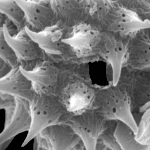 Pollen grain of Acmella sodiroi (scanning electron micrograph). Photo: Patricia Jaramillo Díaz & M. Mar Trigo, CDF, 2011.