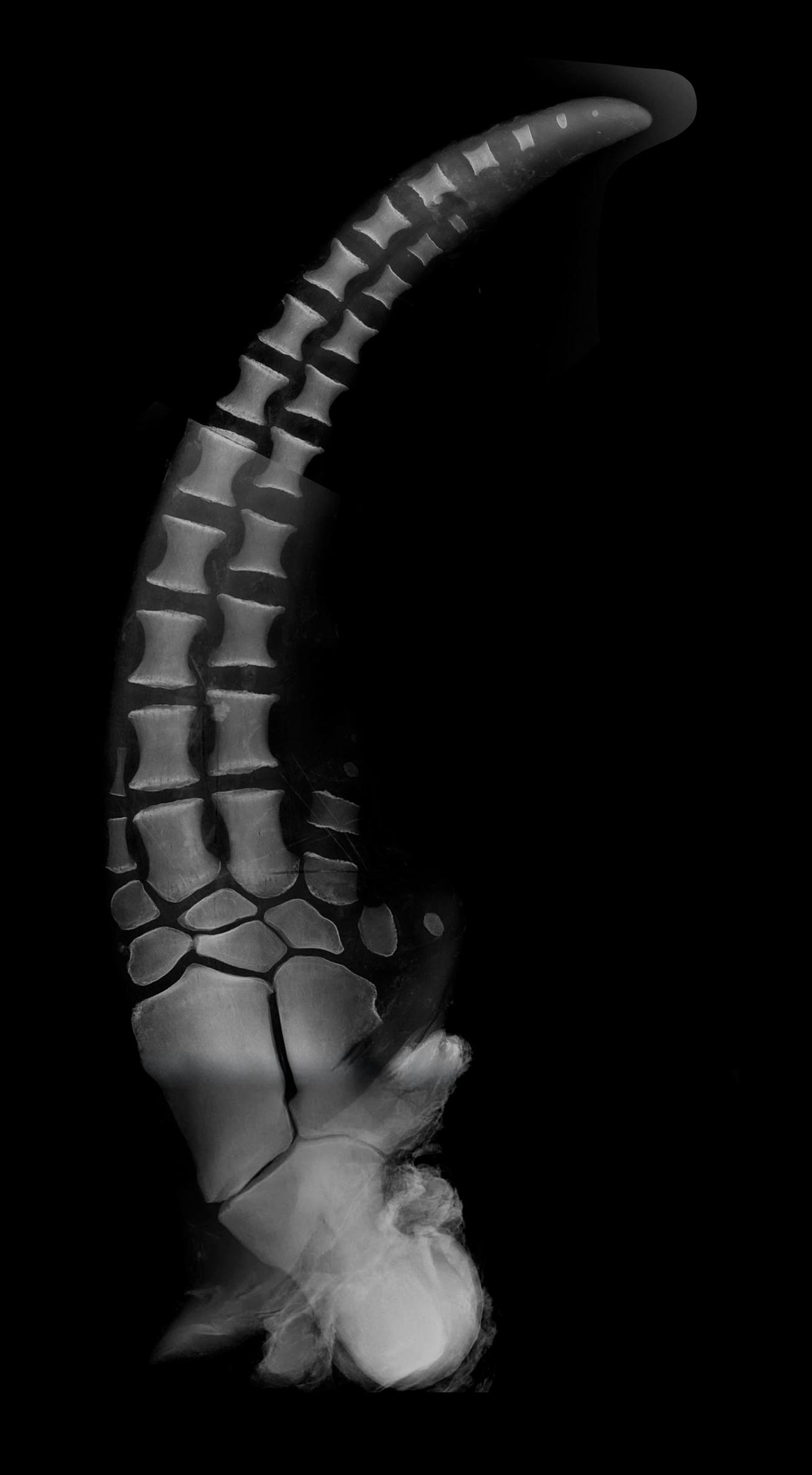 Rayos-X mano izquierda Foto: .