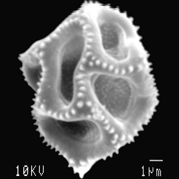 Grano de polen de Alternanthera filifolia ssp. rabidensis Eliasson (foto en microscopio electrónico). Foto: Patricia Jaramillo Díaz & M. Mar Trigo, CDF, 2011.