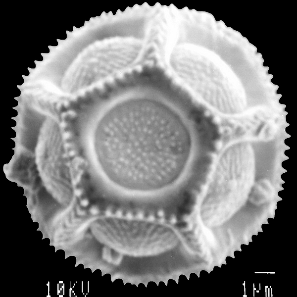 Pollen grain of Alternanthera snodgrassii (scanning electron micrograph). Photo: Patricia Jaramillo Díaz & M. Mar Trigo, CDF, 2011.