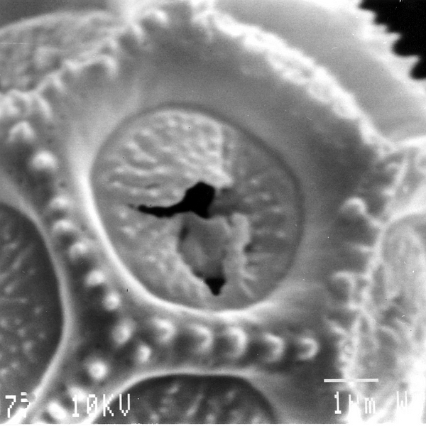 Pollen grain of Alternanthera snodgrassii (B.L. Rob.) Howell (scanning electron micrograph). Photo: Patricia Jaramillo Díaz & M. Mar Trigo, CDF, 2011.