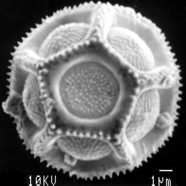 Pollen grain of Alternanthera snodgrassii (scanning electron micrograph). Photo: Patricia Jaramillo Díaz & M. Mar Trigo, CDF, 2011.