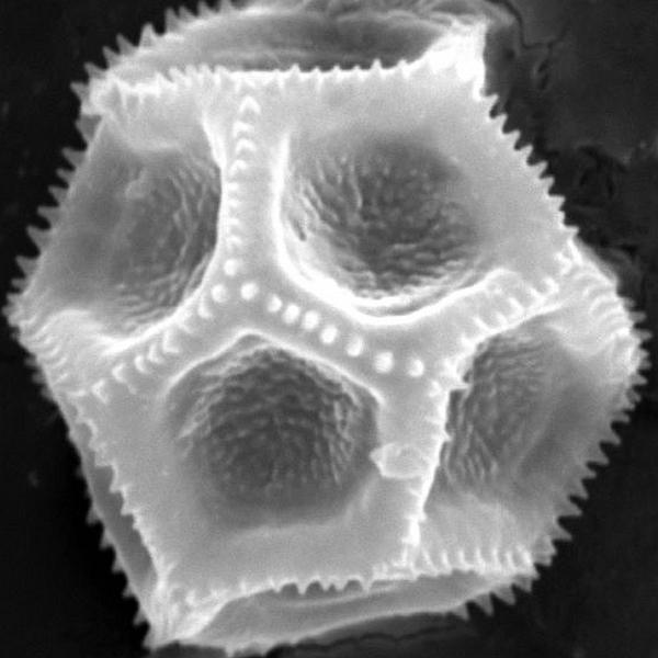 Pollen grain of Alternanthera filifolia ssp. microcephala Eliasson (scanning electron micrograph). Photo: Patricia Jaramillo Díaz & M. Mar Trigo, CDF, 2011.