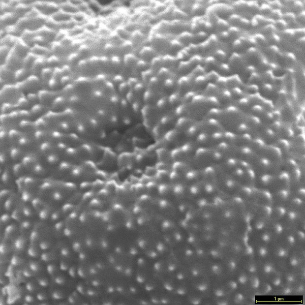 Pollen grain of Amaranthus sclerantoides (scanning electron micrograph). Photo: Patricia Jaramillo Díaz & M. Mar Trigo, CDF, 2011.