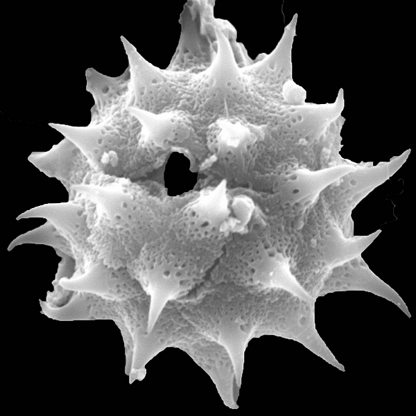 Pollen grain of Chrysanthellum pusillum (scanning electron micrograph). Photo: Patricia Jaramillo Díaz & M. Mar Trigo, CDF, 2011.