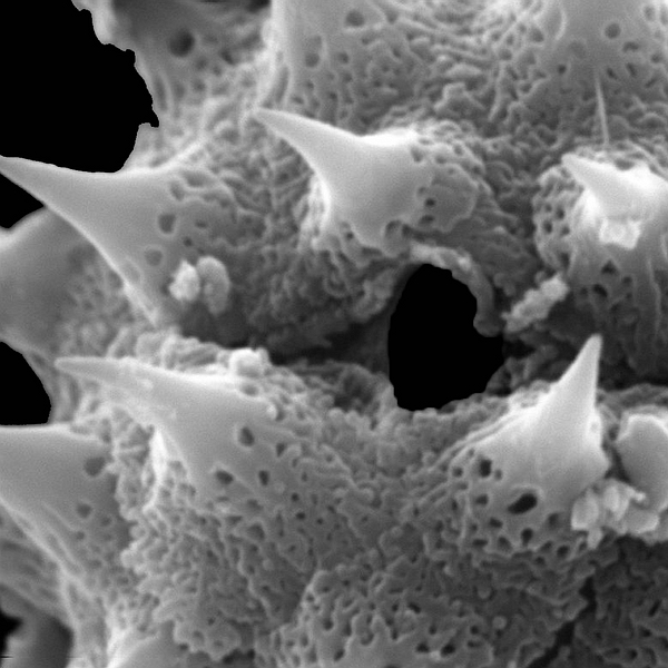 Pollen grain of Chrysanthellum pusillum (scanning electron micrograph). Photo: Patricia Jaramillo Díaz & M. Mar Trigo, CDF, 2011.