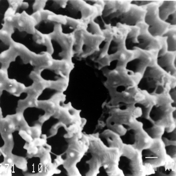 Pollen grain of Cordia anderssonii (scanning electron micrograph). Photo: Patricia Jaramillo Díaz & M. Mar Trigo, CDF, 2011.