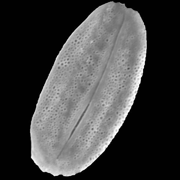 Pollen grain of Dalea tenuicaulis Hook. f. (scanning electron micrograph). Photo: Patricia Jaramillo Díaz & M. Mar Trigo, CDF, 2011.