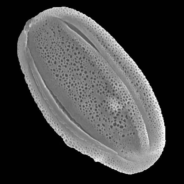 Pollen grain of Dalea tenuicaulis (scanning electron micrograph). Photo: Patricia Jaramillo Díaz & M. Mar Trigo, CDF, 2011.