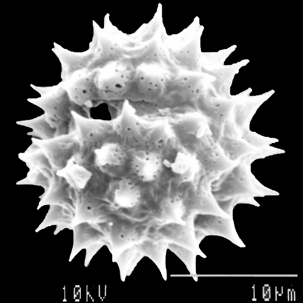 Grano de polen de Darwiniothamnus tenuifolius var. tenuifolius (foto en microscopio electrónico). Foto: Patricia Jaramillo Díaz & M. Mar Trigo, CDF, 2011.