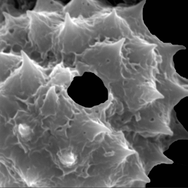 Grano de polen de Darwiniothamnus tenuifolius var. tenuifolius (foto en microscopio electrónico). Foto: Patricia Jaramillo Díaz & M. Mar Trigo, CDF, 2011.