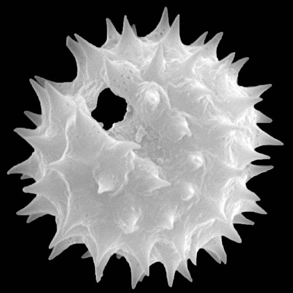 Pollen grain of Darwiniothamnus lancifolius ssp. glabriusculus (scanning electron micrograph). Photo: Patricia Jaramillo Díaz & M. Mar Trigo, CDF, 2011.
