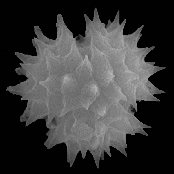 Pollen grain of Darwiniothamnus tenuifolius var. tenuifolius (scanning electron micrograph). Photo: Patricia Jaramillo Díaz & M. Mar Trigo, CDF, 2011.