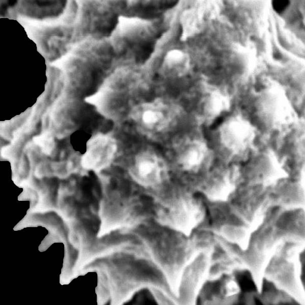 Grano de polen de Encelia hispida (foto en microscopio electrónico). Foto: Patricia Jaramillo Díaz & M. Mar Trigo, CDF, 2011.