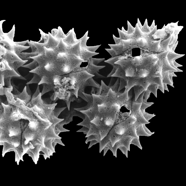 Pollen grain of Jaegeria gracilis (scanning electron micrograph). Photo: Patricia Jaramillo Díaz & M. Mar Trigo, CDF, 2011.