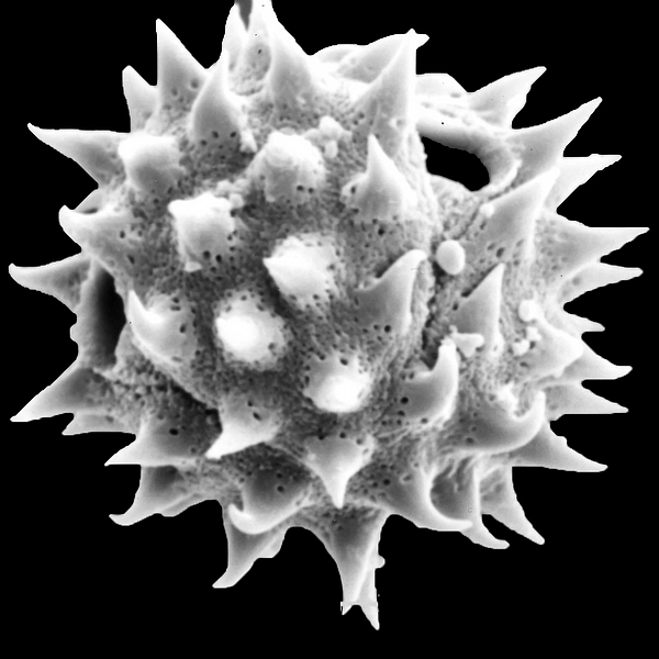 Pollen grain of Jaegeria gracilis Hook. f. (scanning electron micrograph). Photo: Patricia Jaramillo Díaz & M. Mar Trigo, CDF, 2011.