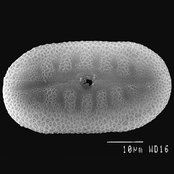 Pollen grain of Justicia galapagana (scanning electron micrograph). Photo: Patricia Jaramillo Díaz & M. Mar Trigo, CDF, 2011.