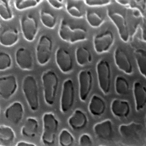 Grano de polen de Justicia galapagana (foto en microscopio electrónico). Foto: Patricia Jaramillo Díaz & M. Mar Trigo, CDF, 2011.