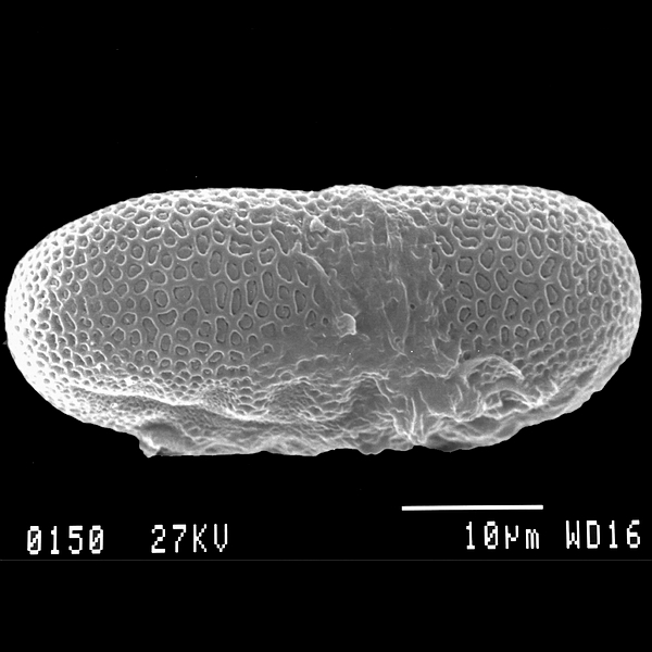 Grano de polen de Justicia galapagana Lindau (foto en microscopio electrónico). Foto: Patricia Jaramillo Díaz & M. Mar Trigo, CDF, 2011.