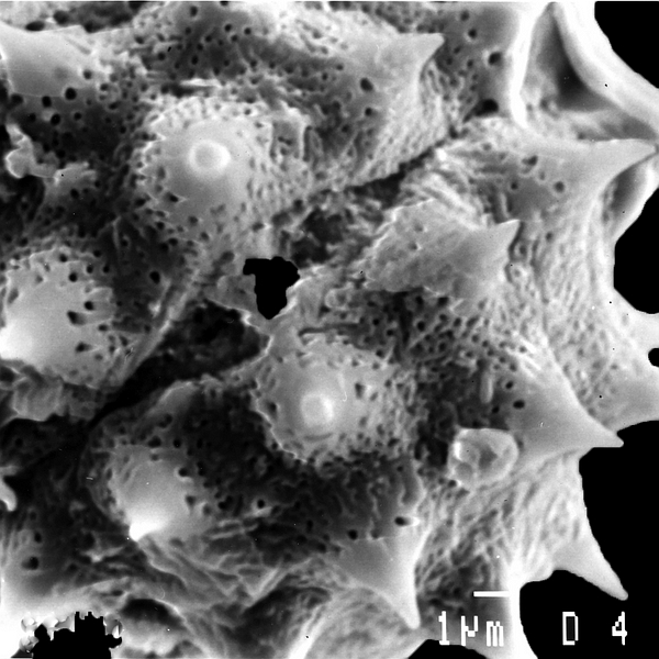 Pollen grain of Lecocarpus lecocarpoides (scanning electron micrograph). Photo: Patricia Jaramillo Díaz & M. Mar Trigo, CDF, 2011.