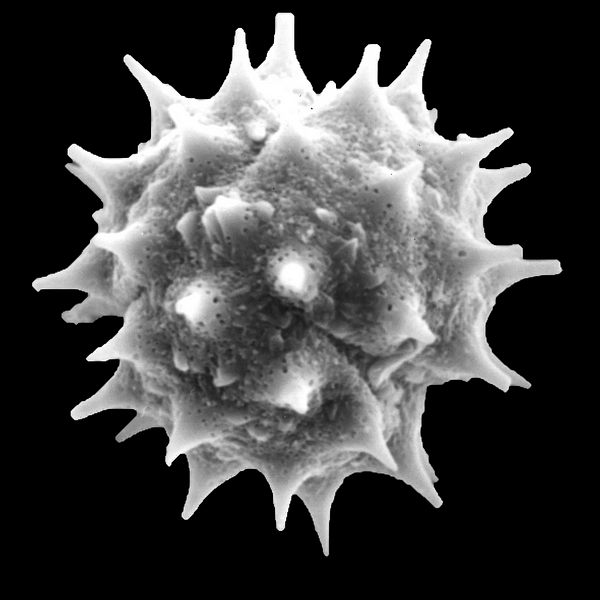 Pollen grain of Lecocarpus lecocarpoides (B.L. Rob. & Greenm.) Cronquist & Stuessy (scanning electron micrograph). Photo: Patricia Jaramillo Díaz & M. Mar Trigo, CDF, 2011.