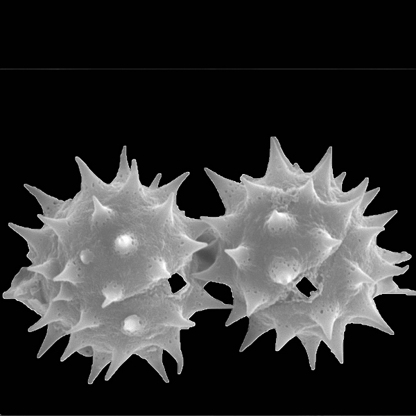 Pollen grain of Lecocarpus pinnatifidus (scanning electron micrograph). Photo: Patricia Jaramillo Díaz & M. Mar Trigo, CDF, 2011.