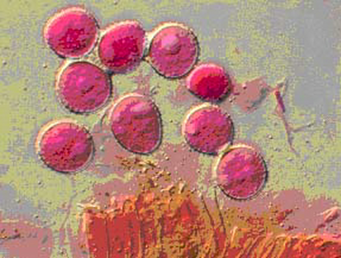 Cerotelium fici , phytopathogenic fungus. Photo: Franklin Arboleda, CDF, 2006.