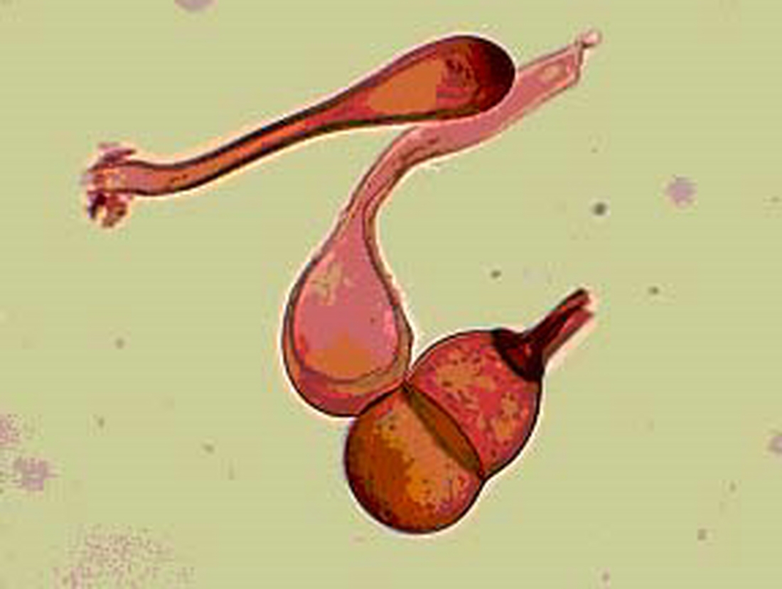 Puccinia melanocephala , hongo fitopatogénico. Foto: Franklin Arboleda, CDF, 2006.