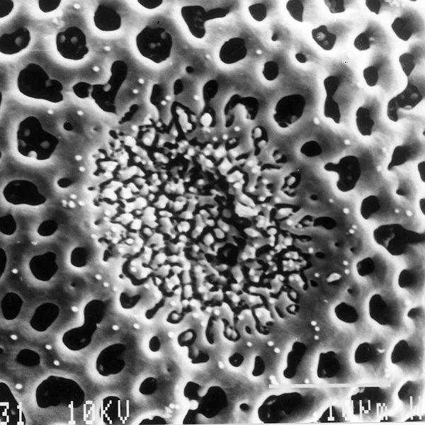 Pollen grain of Opuntia echios var. gigantea Howell (scanning electron micrograph). Photo: Patricia Jaramillo Díaz & M. Mar Trigo, CDF, 2011.