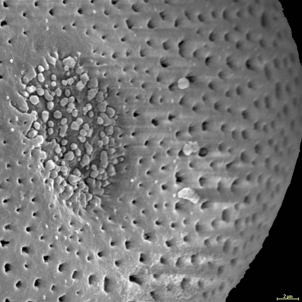 Pollen grain of Opuntia galapageia var. galapageia (scanning electron micrograph). Photo: Patricia Jaramillo Díaz & M. Mar Trigo, CDF, 2011.