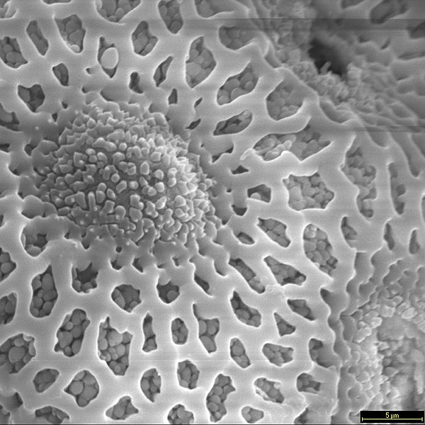 Pollen grain of Opuntia insularis (scanning electron micrograph). Photo: Patricia Jaramillo Díaz & M. Mar Trigo, CDF, 2011.