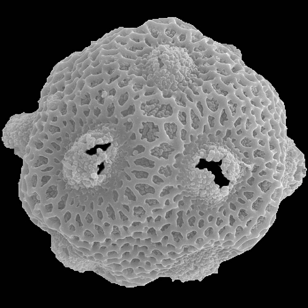 Pollen grain of Opuntia insularis A. Stewart (scanning electron micrograph). Photo: Patricia Jaramillo Díaz & M. Mar Trigo, CDF, 2011.