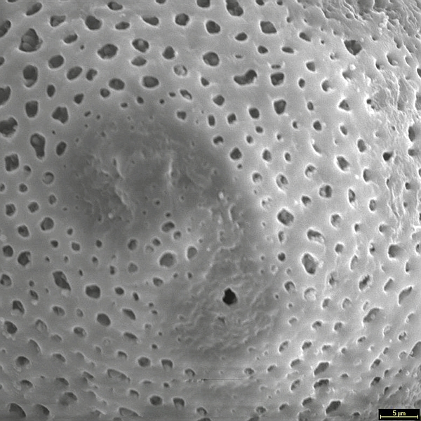 Pollen grain of Opuntia megasperma var. megasperma (scanning electron micrograph). Photo: Patricia Jaramillo Díaz & M. Mar Trigo, CDF, 2011.