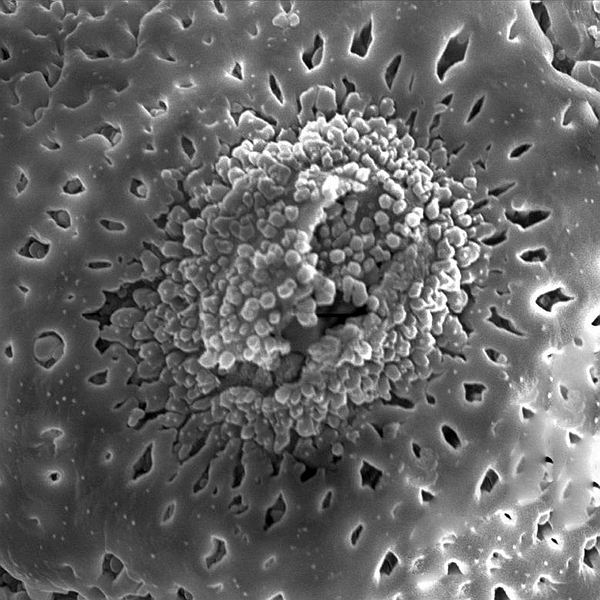 Pollen grain of Opuntia megasperma var. mesophytica (scanning electron micrograph). Photo: Patricia Jaramillo Díaz & M. Mar Trigo, CDF, 2011.