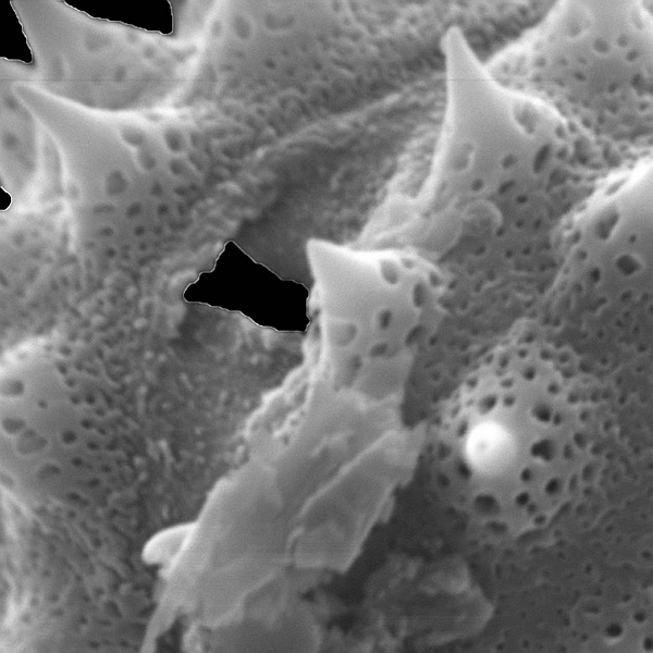 Pollen grain of Pectis subsquarrosa (scanning electron micrograph). Photo: Patricia Jaramillo Díaz & M. Mar Trigo, CDF, 2011.