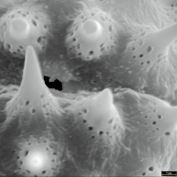 Pollen grain of Scalesia affinis ssp. gummifera (scanning electron micrograph). Photo: Patricia Jaramillo Díaz & M. Mar Trigo, CDF, 2011.