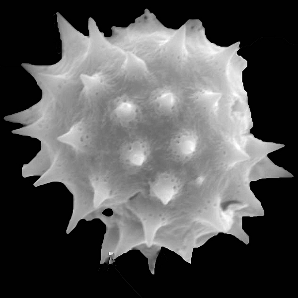 Pollen grain of Scalesia gordilloi O. Hamann & Wium-And. (scanning electron micrograph). Photo: Patricia Jaramillo Díaz & M. Mar Trigo, CDF, 2011.