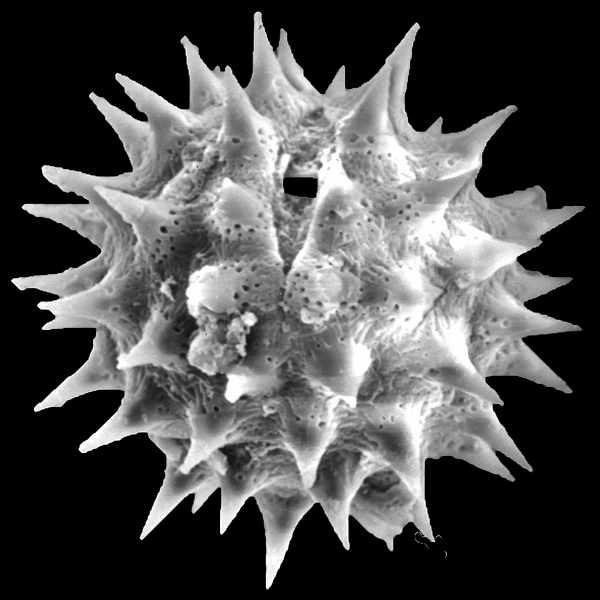 Pollen grain of Scalesia atractyloides var. atractyloides Arn. (scanning electron micrograph). Photo: Patricia Jaramillo Díaz & M. Mar Trigo, CDF, 2011.