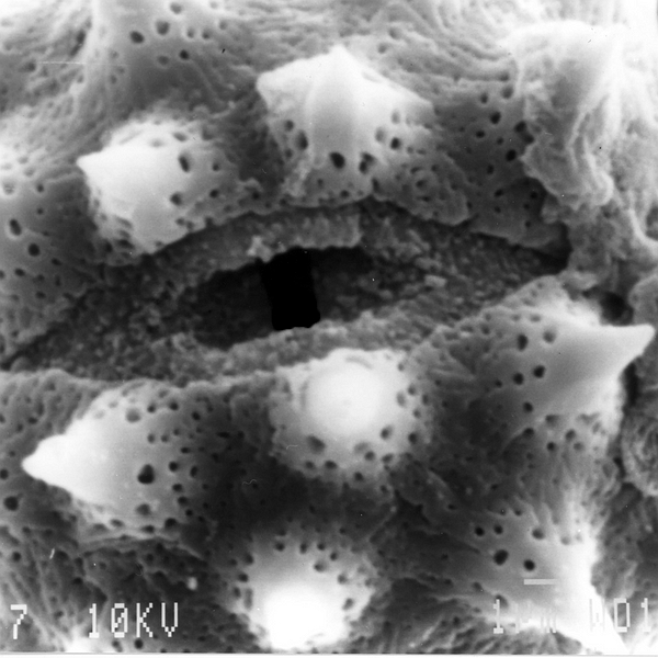 Pollen grain of Scalesia atractyloides var. atractyloides (scanning electron micrograph). Photo: Patricia Jaramillo Díaz & M. Mar Trigo, CDF, 2011.