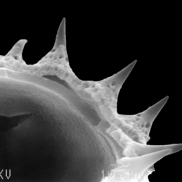 Pollen grain of Scalesia baurii ssp. baurii (scanning electron micrograph). Photo: Patricia Jaramillo Díaz & M. Mar Trigo, CDF, 2011.