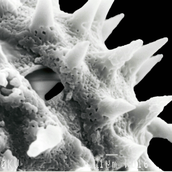 Pollen grain of Scalesia baurii ssp. baurii (scanning electron micrograph). Photo: Patricia Jaramillo Díaz & M. Mar Trigo, CDF, 2011.