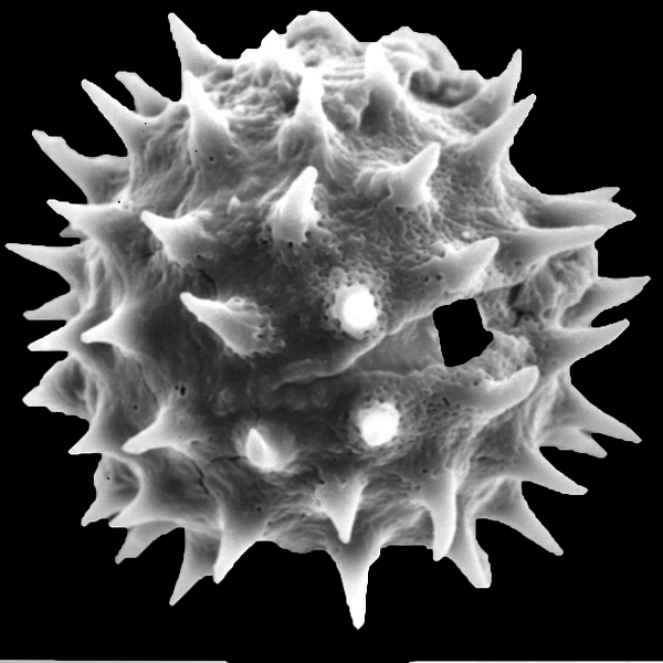 Pollen grain of Scalesia baurii ssp. baurii B.L. Rob. & Greenm. (scanning electron micrograph). Photo: Patricia Jaramillo Díaz & M. Mar Trigo, CDF, 2011.