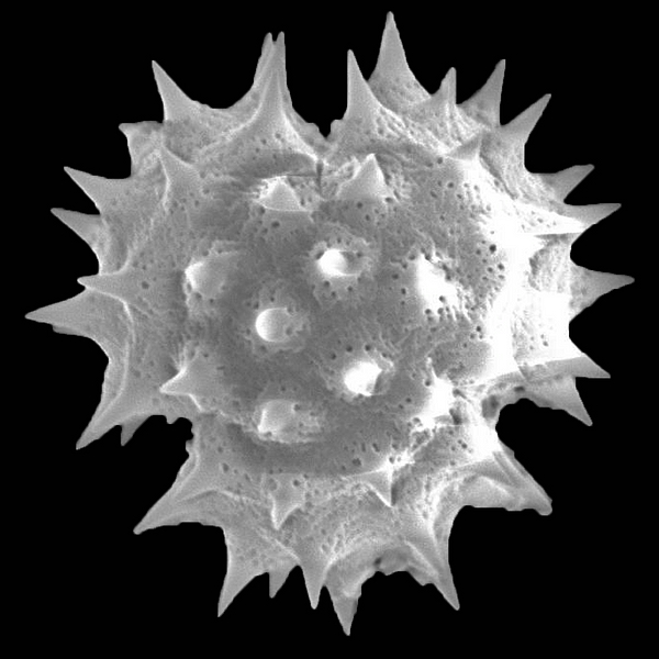 Pollen grain of Scalesia baurii ssp. hopkinsii (scanning electron micrograph). Photo: Patricia Jaramillo Díaz & M. Mar Trigo, CDF, 2011.