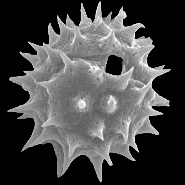 Grano de polen de Scalesia divisa (foto en microscopio electrónico). Foto: Patricia Jaramillo Díaz & M. Mar Trigo, CDF, 2011.