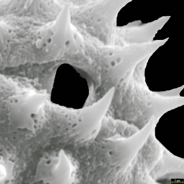 Grano de polen de Scalesia divisa (foto en microscopio electrónico). Foto: Patricia Jaramillo Díaz & M. Mar Trigo, CDF, 2011.
