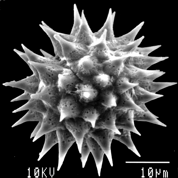 Pollen grain of Scalesia helleri ssp. santacruziana Harling (scanning electron micrograph). Photo: Patricia Jaramillo Díaz & M. Mar Trigo, CDF, 2011.