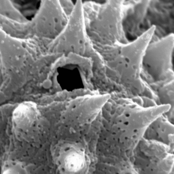 Pollen grain of Scalesia microcephala var. microcephala (scanning electron micrograph). Photo: Patricia Jaramillo Díaz & M. Mar Trigo, CDF, 2011.