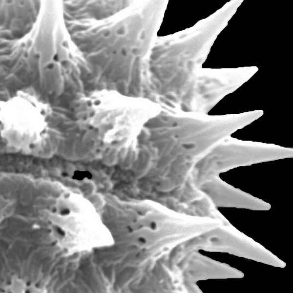 Grano de polen de Scalesia retroflexa Hemsl. (foto en microscopio electrónico). Foto: Patricia Jaramillo Díaz & M. Mar Trigo, CDF, 2011.